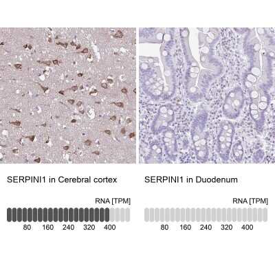 Immunohistochemistry-Paraffin: Serpin I1/Neuroserpin Antibody [NBP2-38784]