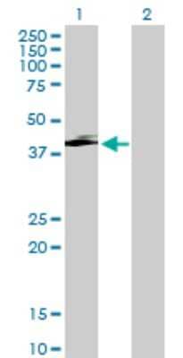 Western Blot: Serpin I2 Antibody [H00005276-B02P]