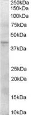 Western Blot: Serpin I2 Antibody [NB100-1782]