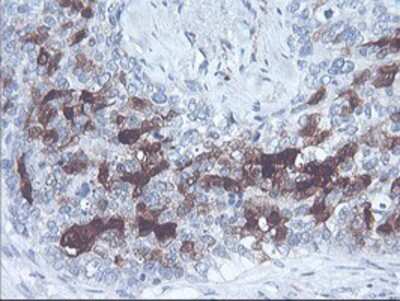 Immunohistochemistry-Paraffin: SerpinB2 Antibody (OTI1G3) [NBP2-01492]