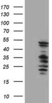 Western Blot: SerpinB2 Antibody (OTI1G3) [NBP2-01492]