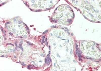 Immunohistochemistry: SerpinB2 Antibody [NBP1-77964]