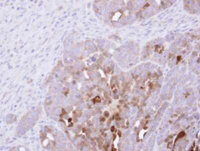 Immunohistochemistry-Paraffin: SerpinB2 Antibody [NBP1-33188]