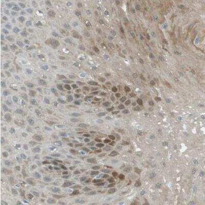 Immunohistochemistry-Paraffin: SerpinB2 Antibody [NBP1-83163]