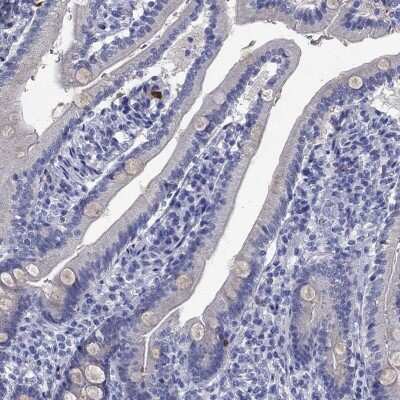 Immunohistochemistry-Paraffin: SerpinB2 Antibody [NBP3-17002]