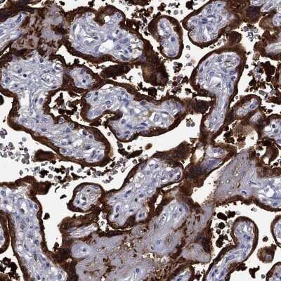 Immunohistochemistry-Paraffin: SerpinB2 Antibody [NBP3-17002]