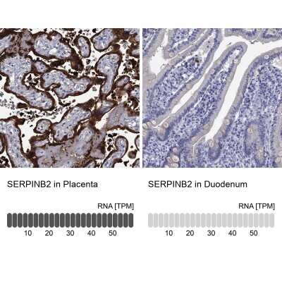 Immunohistochemistry-Paraffin: SerpinB2 Antibody [NBP3-17002]