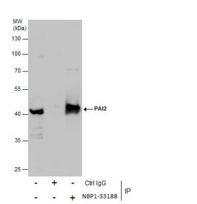 Immunoprecipitation: SerpinB2 Antibody [NBP1-33188]