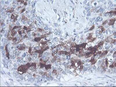 Immunohistochemistry: SerpinB2 Antibody (OTI1G3) - Azide and BSA Free [NBP2-74131]