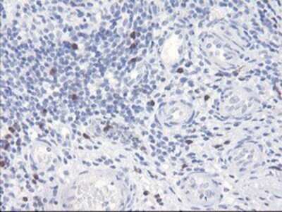 Immunohistochemistry: SerpinB2 Antibody (OTI1G3) - Azide and BSA Free [NBP2-74131]