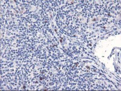 Immunohistochemistry: SerpinB2 Antibody (OTI1G3) - Azide and BSA Free [NBP2-74131]