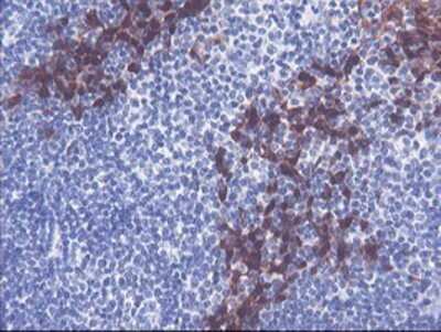 Immunohistochemistry: SerpinB2 Antibody (OTI1G3) - Azide and BSA Free [NBP2-74131]