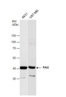 Western Blot: SerpinB2 Antibody [NBP1-33188]