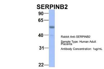 Western Blot: SerpinB2 Antibody [NBP1-59086]