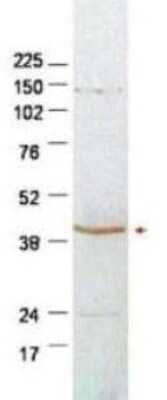 Western Blot: SerpinB2 Antibody [NBP1-77964]