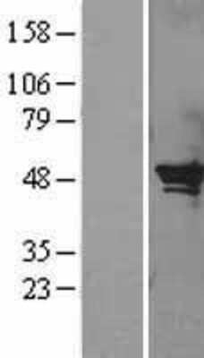 Western Blot: SerpinB2 Overexpression Lysate [NBL1-15845]