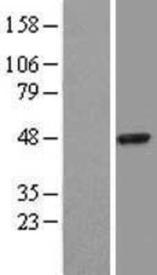 Western Blot: Serpin B3/SCCA1 Overexpression Lysate [NBL1-15846]