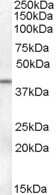 Western Blot: Serpin B6 Antibody [NB100-93464]