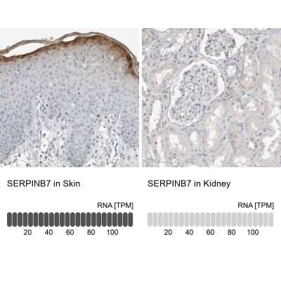 Immunohistochemistry-Paraffin: SerpinB7 Antibody [NBP1-82782]