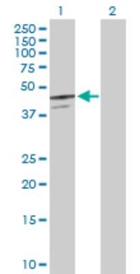 Western Blot: SerpinB7 Antibody [H00008710-D01P]