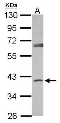 Western Blot: SerpinB7 Antibody [NBP2-20312]