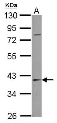 Western Blot: SerpinB7 Antibody [NBP2-20313]