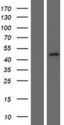 Western Blot: SerpinB7 Overexpression Lysate [NBP2-07954]