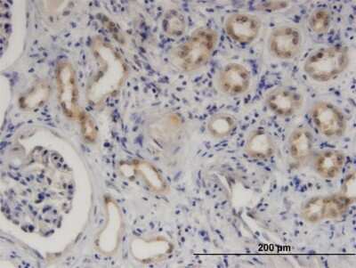 Immunohistochemistry-Paraffin: SerpinB9 Antibody (1F5) [H00005272-M06]