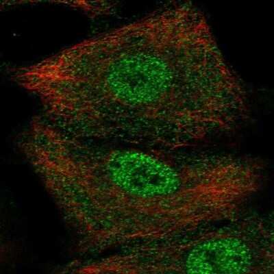 Immunocytochemistry/ Immunofluorescence: SerpinB9 Antibody [NBP2-33924]