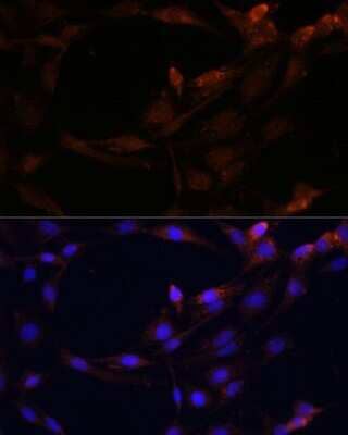 Immunocytochemistry/ Immunofluorescence: SerpinB9 Antibody - BSA Free [NBP2-93879]