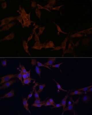 Immunocytochemistry/ Immunofluorescence: SerpinB9 Antibody - BSA Free [NBP2-93879]