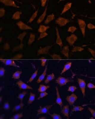 Immunocytochemistry/ Immunofluorescence: SerpinB9 Antibody - BSA Free [NBP2-93879]