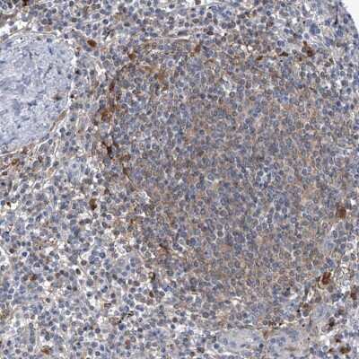 Immunohistochemistry-Paraffin: SerpinB9 Antibody [NBP2-33924]