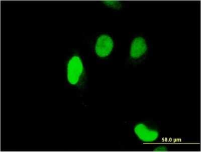 Immunocytochemistry/ Immunofluorescence: Sertad1 Antibody (3H4) [H00029950-M07]