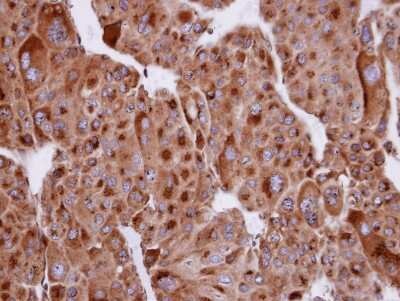 Immunohistochemistry-Paraffin: Sertad1 Antibody [NBP1-31052]