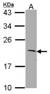 Western Blot: Sertad1 Antibody [NBP1-31052]