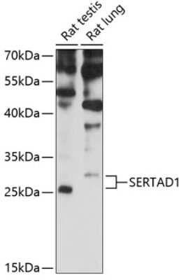 Western Blot: Sertad1 AntibodyAzide and BSA Free [NBP2-94785]