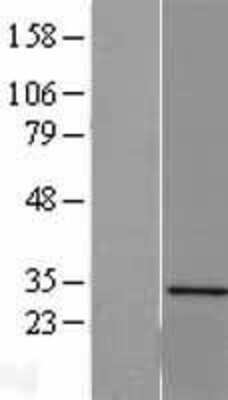 Western Blot: Sertad1 Overexpression Lysate [NBL1-15859]