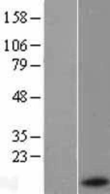 Western Blot: Serum Amyloid A1 Overexpression Lysate [NBL1-15670]