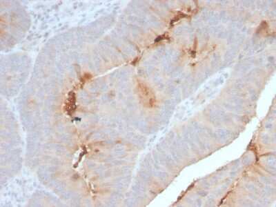 Immunohistochemistry-Paraffin: Serum Amyloid A1/A2 Antibody (SAA/2868R) - Azide and BSA Free [NBP3-08413]