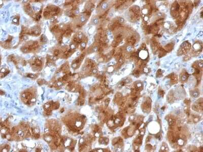 Immunohistochemistry-Paraffin: Serum Amyloid A1/A2 Antibody (SAA/326) - Azide and BSA Free [NBP3-08412]