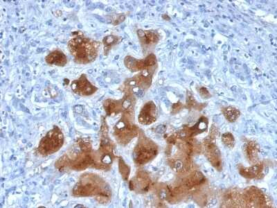 Immunohistochemistry-Paraffin: Serum Amyloid A1/A2 Antibody (SAA/326) - Azide and BSA Free [NBP3-08412]