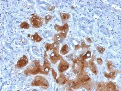 Immunohistochemistry-Paraffin: Serum Amyloid A1/A2 Antibody (SAA/326) [NBP3-07766]