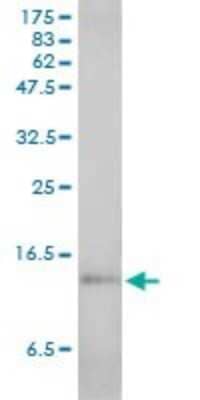 Western Blot: Serum Amyloid A1 Antibody (3C11-2C1) [H00006288-M01]