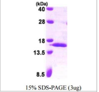 SDS-PAGE: Recombinant Human Serum Amyloid A4 His Protein [NBP1-50879]