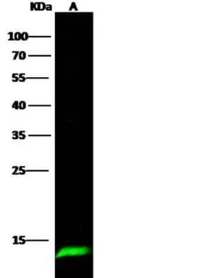 Western Blot: Serum Amyloid A4 Antibody (001) [NBP2-89887]