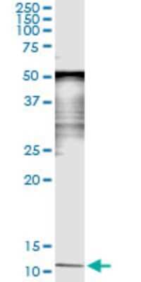 Immunoprecipitation: Serum Amyloid A4 Antibody (3C11) [H00006291-M08]