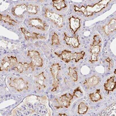 Immunohistochemistry-Paraffin: Serum Amyloid A4 Antibody [NBP2-32517]