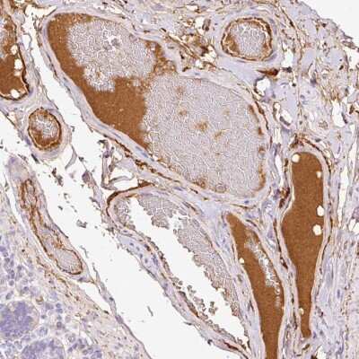 Immunohistochemistry: Pentraxin 2/SAP Antibody [NBP2-31392]