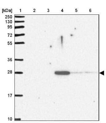 Western Blot: Pentraxin 2/SAP Antibody [NBP2-31392]